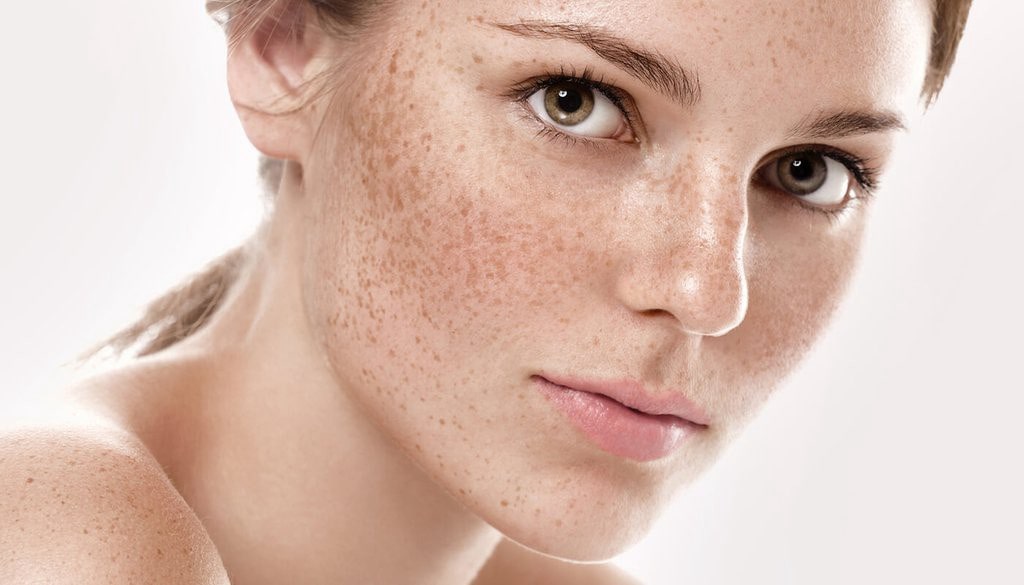 Serum trị mụn nám Detox BlanC ESSENCE PEPTIDE